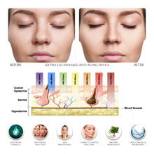 XTREME Skin Rejuvenation Device | Hot & Cold LED Light Therapy